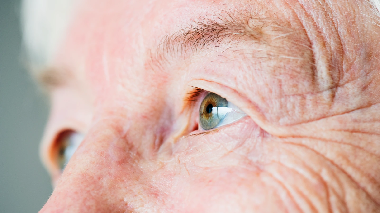 Diabetic eye exams
